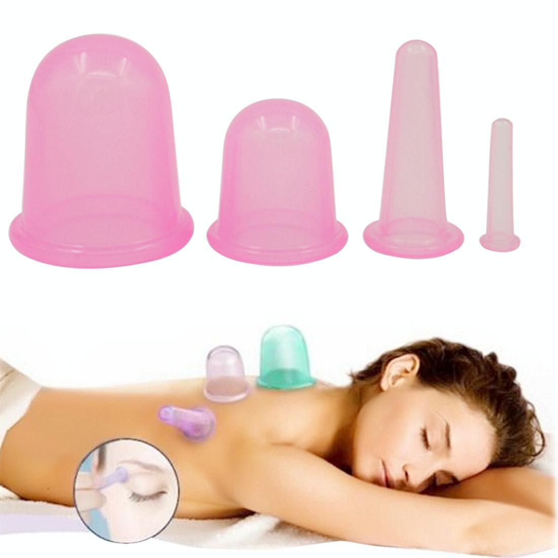 V562-1535CH-202508280310-00 4-In-1 Silicone Cupping Cups For Health Care Random Colour - Image 1